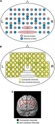 Young female participants show blunted placebo effects associated with blunted responses to a cue predicting a safe stimulus in the right dorsolateral prefrontal cortex